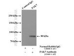 PAK4/6/7 Antibody in Immunoprecipitation (IP)