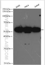 KPNA4 Antibody in Western Blot (WB)