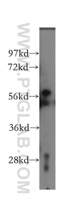 KPNA4 Antibody in Western Blot (WB)