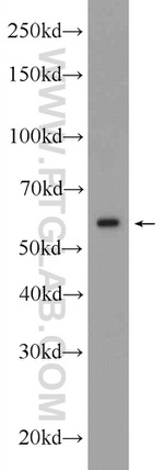 KPNA4 Antibody in Western Blot (WB)