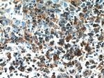 PIP4K2A Antibody in Immunohistochemistry (Paraffin) (IHC (P))