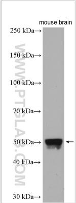 PIP4K2A Antibody in Western Blot (WB)