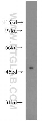 PIP4K2A Antibody in Western Blot (WB)