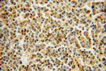 LCK Antibody in Immunohistochemistry (Paraffin) (IHC (P))