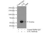 LCK Antibody in Immunoprecipitation (IP)