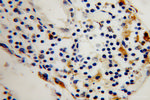 TPP1 Antibody in Immunohistochemistry (Paraffin) (IHC (P))