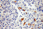 TPP1 Antibody in Immunohistochemistry (Paraffin) (IHC (P))