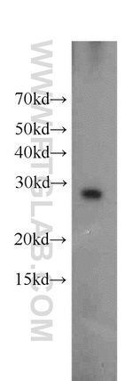 Ephrin A3 Antibody in Western Blot (WB)