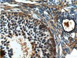 COQ6 Antibody in Immunohistochemistry (Paraffin) (IHC (P))