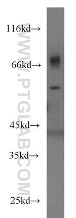 PDCD7 Antibody in Western Blot (WB)