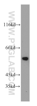 CYP46A1 Antibody in Western Blot (WB)