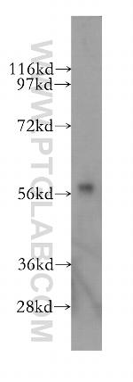 CYP46A1 Antibody in Western Blot (WB)