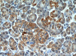 TBL2 Antibody in Immunohistochemistry (Paraffin) (IHC (P))