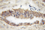 TBL2 Antibody in Immunohistochemistry (Paraffin) (IHC (P))