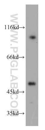 TBL2 Antibody in Western Blot (WB)