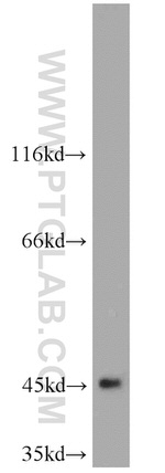 TBL2 Antibody in Western Blot (WB)