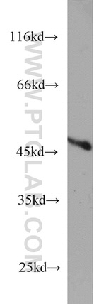 TBL2 Antibody in Western Blot (WB)