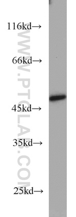 TBL2 Antibody in Western Blot (WB)