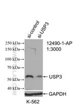 USP3 Antibody in Western Blot (WB)