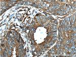 CD46 Antibody in Immunohistochemistry (Paraffin) (IHC (P))