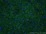 mu Crystallin Antibody in Immunohistochemistry (PFA fixed) (IHC (PFA))