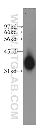 mu Crystallin Antibody in Western Blot (WB)