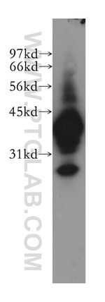 mu Crystallin Antibody in Western Blot (WB)