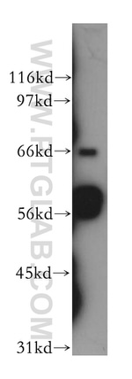 SHC Antibody in Western Blot (WB)