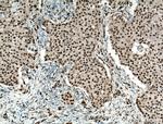 FOX2/RBM9 Antibody in Immunohistochemistry (Paraffin) (IHC (P))