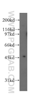 Kir4.1 Antibody in Western Blot (WB)