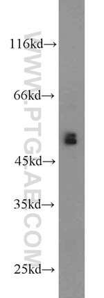 BBS8 Antibody in Western Blot (WB)