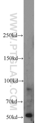 BBS8 Antibody in Western Blot (WB)