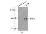 BBS8 Antibody in Immunoprecipitation (IP)