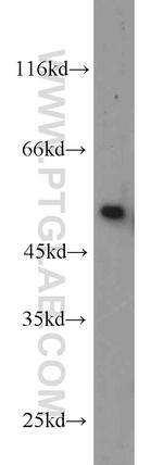 BBS8 Antibody in Western Blot (WB)