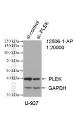 PLEK Antibody in Western Blot (WB)