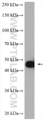 MAGEA4 Antibody in Western Blot (WB)