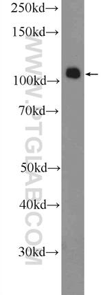 SMARCAL1 Antibody in Western Blot (WB)