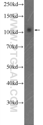 SMARCAL1 Antibody in Western Blot (WB)