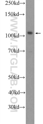 SMARCAL1 Antibody in Western Blot (WB)