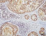 HSF1 Antibody in Immunohistochemistry (PFA fixed) (IHC (PFA))