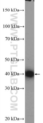 TMOD3 Antibody in Western Blot (WB)