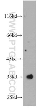 SULT1E1 Antibody in Western Blot (WB)