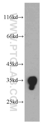 SULT1E1 Antibody in Western Blot (WB)