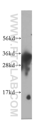 SULT1E1 Antibody in Western Blot (WB)