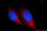 CHMP2B Antibody in Immunocytochemistry (ICC/IF)