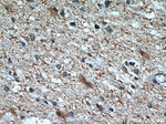 CHMP2B Antibody in Immunohistochemistry (Paraffin) (IHC (P))