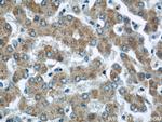 CHMP2B Antibody in Immunohistochemistry (Paraffin) (IHC (P))