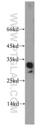 CHMP2B Antibody in Western Blot (WB)