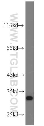 CHMP2B Antibody in Western Blot (WB)