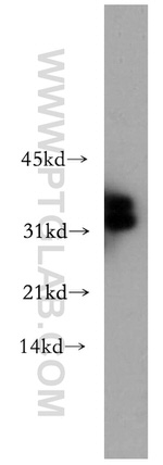 CHMP2B Antibody in Western Blot (WB)